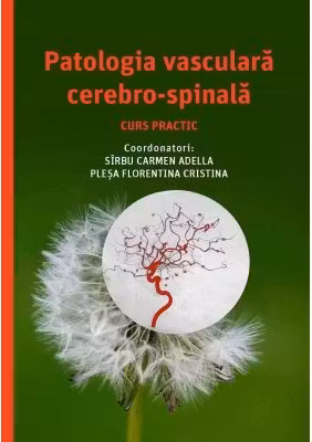 Patologia vasculara cerebro-spinala, curs practic - Carmen-Adella Sirbu, Florentina Cristina Plesa